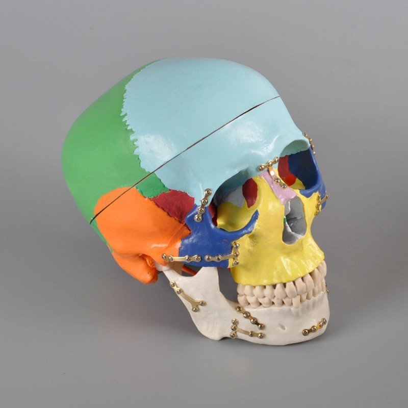 Anatomical Skull Model Colored with Titanium Plate