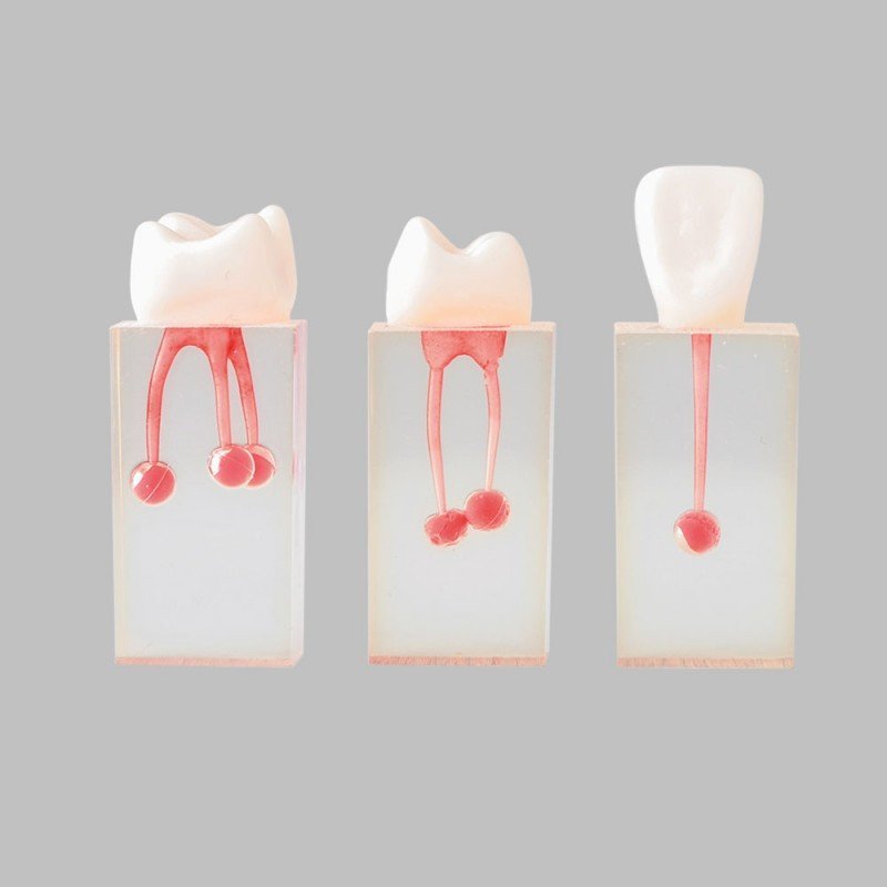 Root Canal Model for Practice