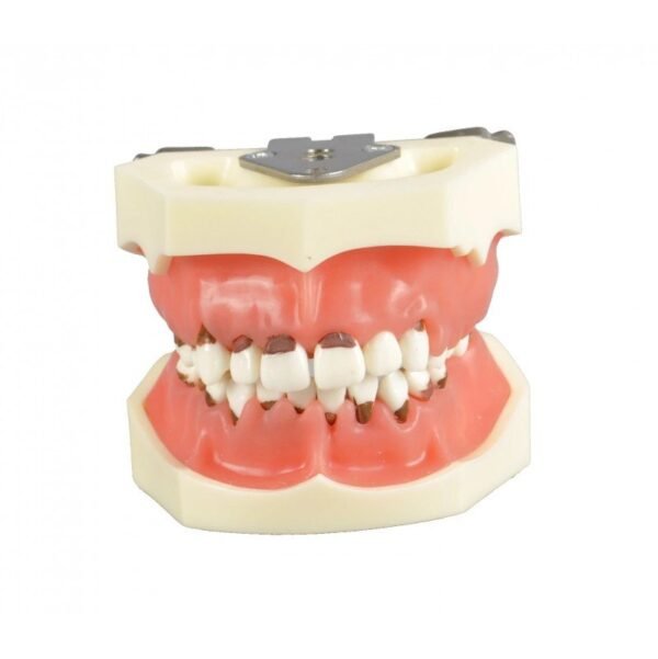 Periodontal model with 3 cases