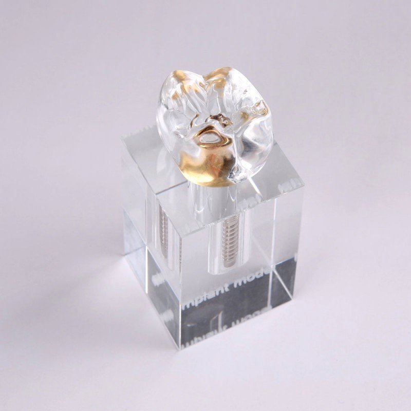 Crystal Implant Model Three Parts Integrated