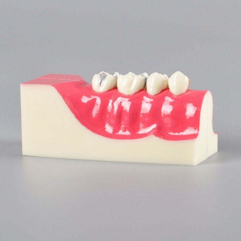 Molar Cross Section Study Model - Image 2