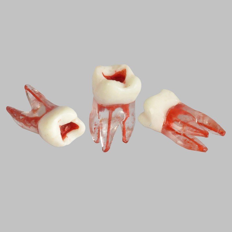Root pulp cavity model for training or practice - Image 5