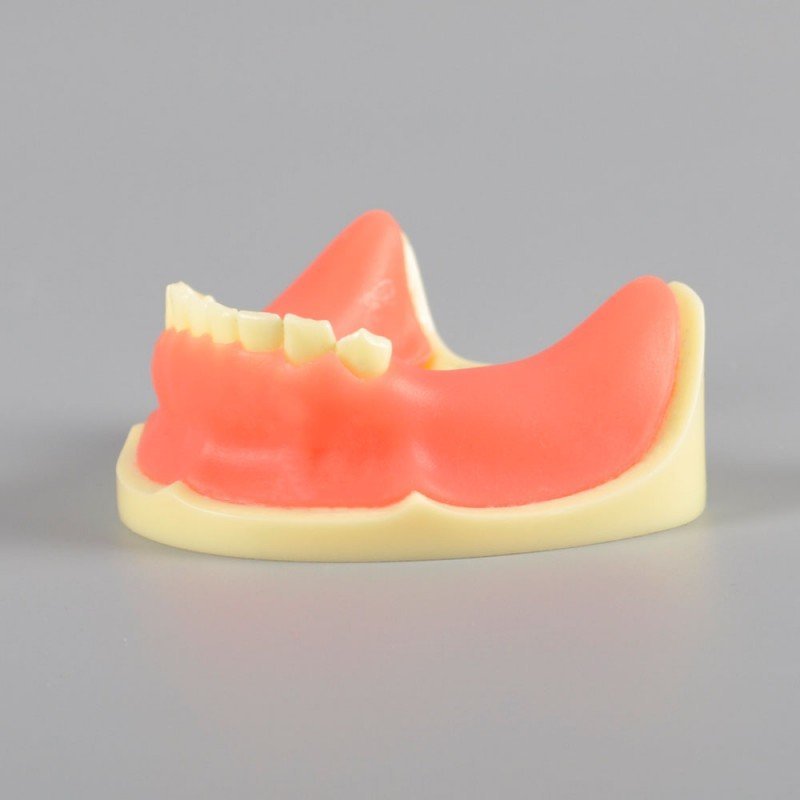 Implant Practice Model Mandibular Jaw Model With Imitation Bone