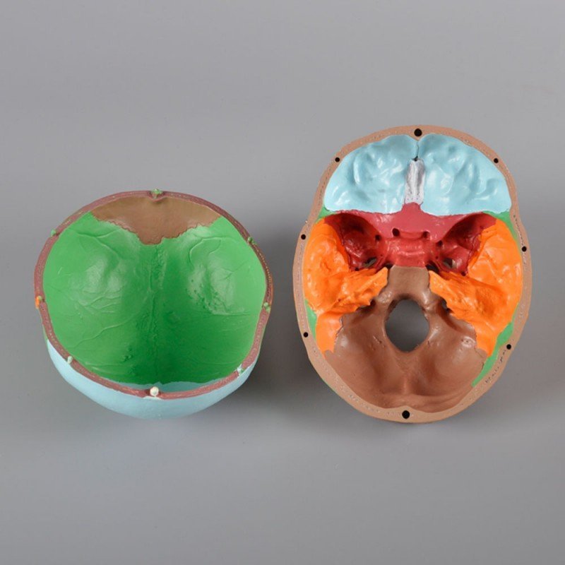 Anatomical Skull Model Colored with Titanium Plate - Image 3