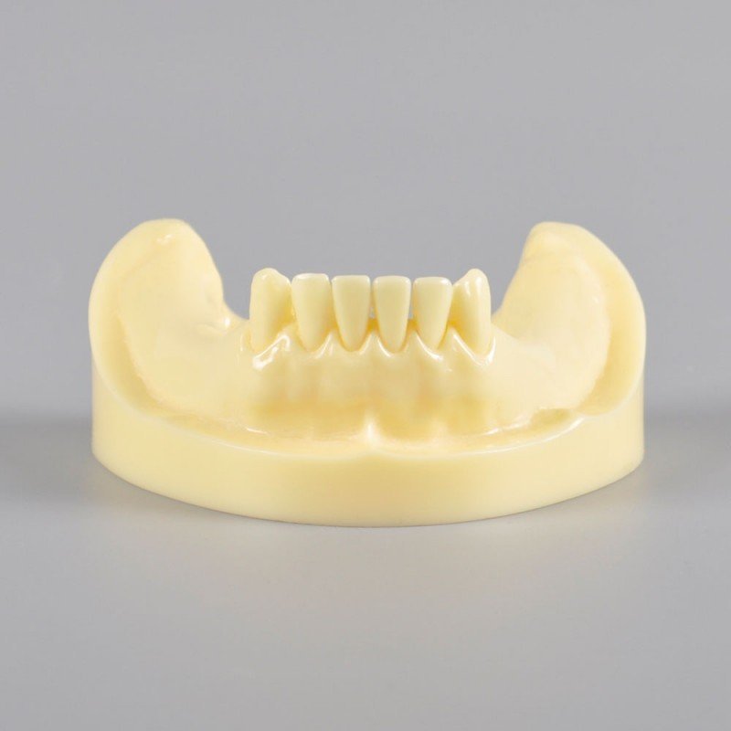 Implant Practice Model Mandibular Jaw Model With Imitation Bone - Image 2