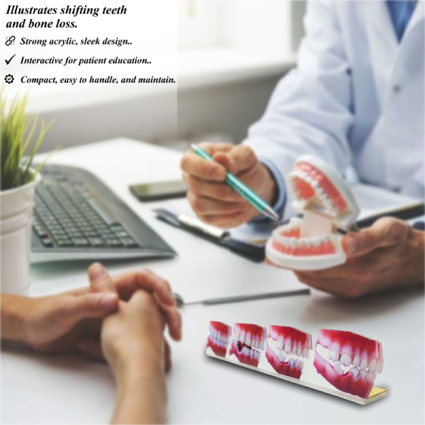 Dental 2D Model Ð Consequences of Missing Teeth Educational Model