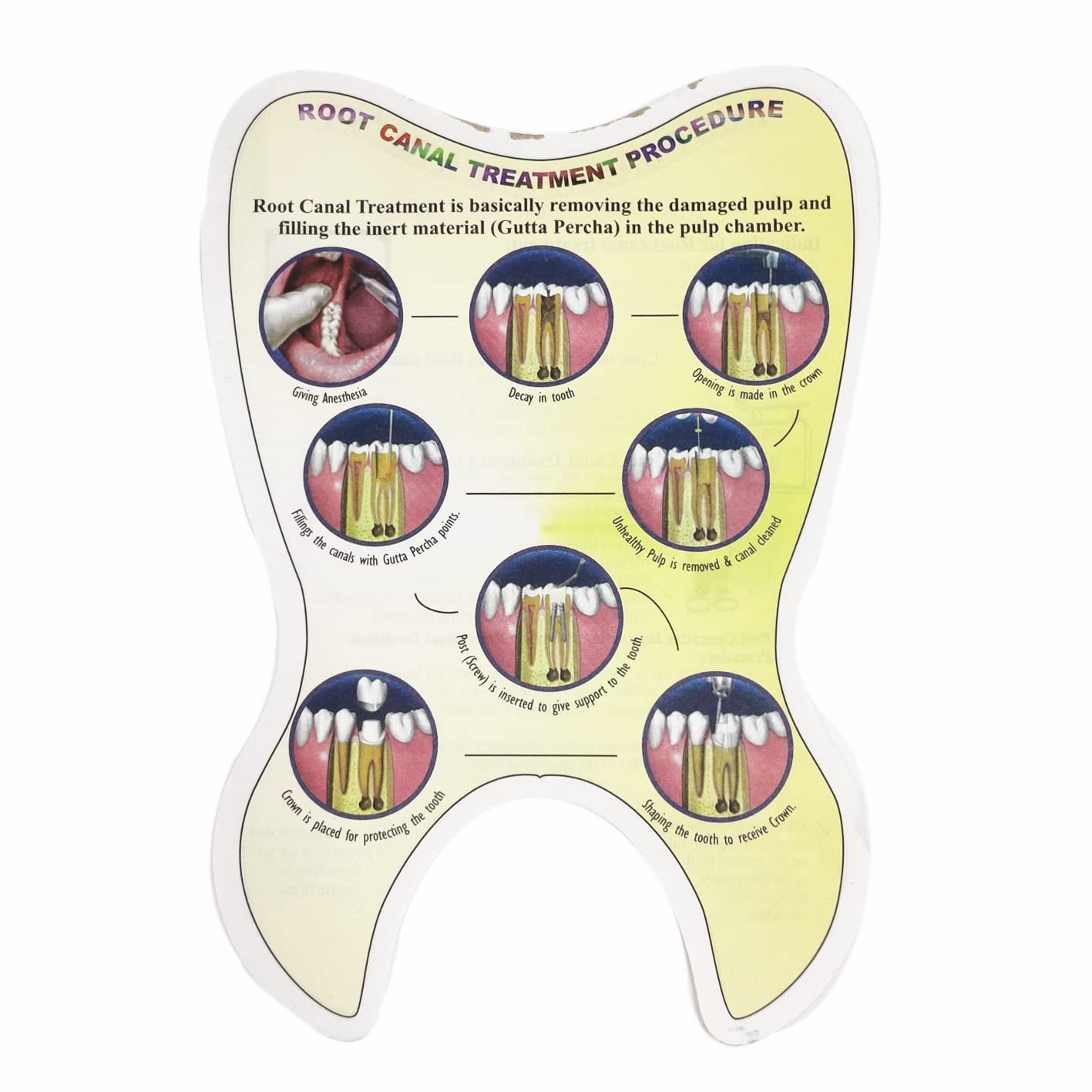 Unique Dents Root canal Treatment Educative Pads, Brouchers, Templates, Patient Education Material, Patient Education booklets, Patient Educational Leaflets/Set of 4 pads