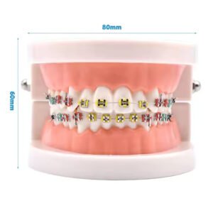 Patient Education Model With Orthodontic Brackets