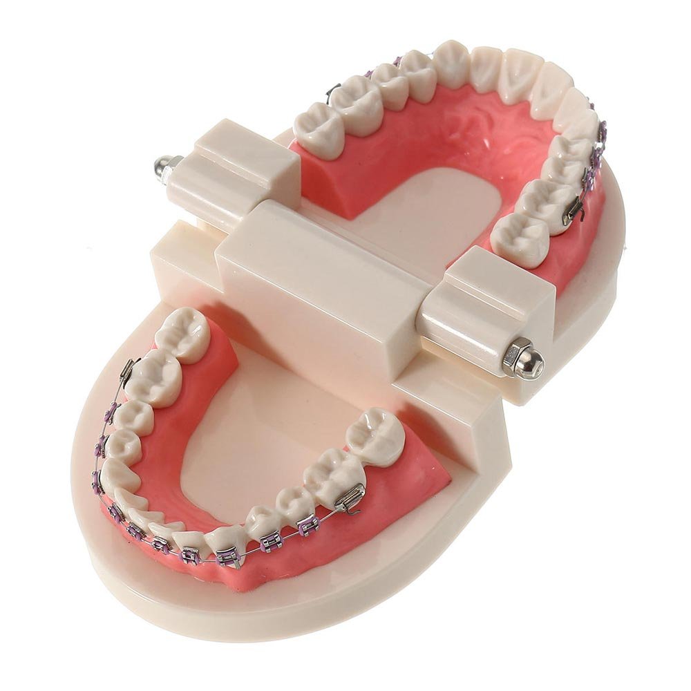 Patient Education Model With Orthodontic Brackets