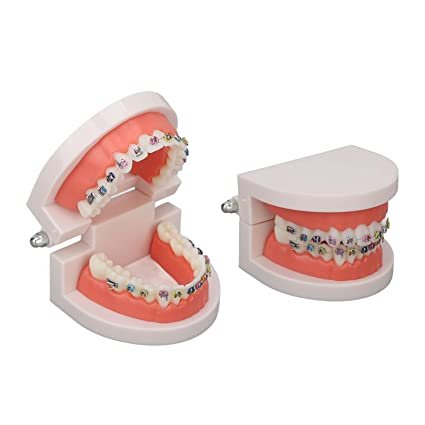 Patient Education Model With Orthodontic Brackets