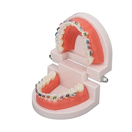 Patient Education Model With Orthodontic Brackets