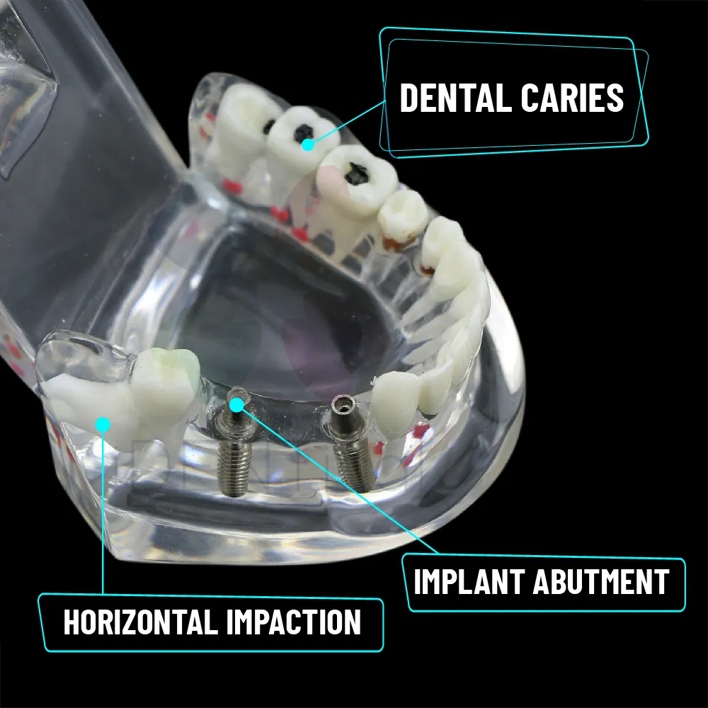 Dental All In One Model