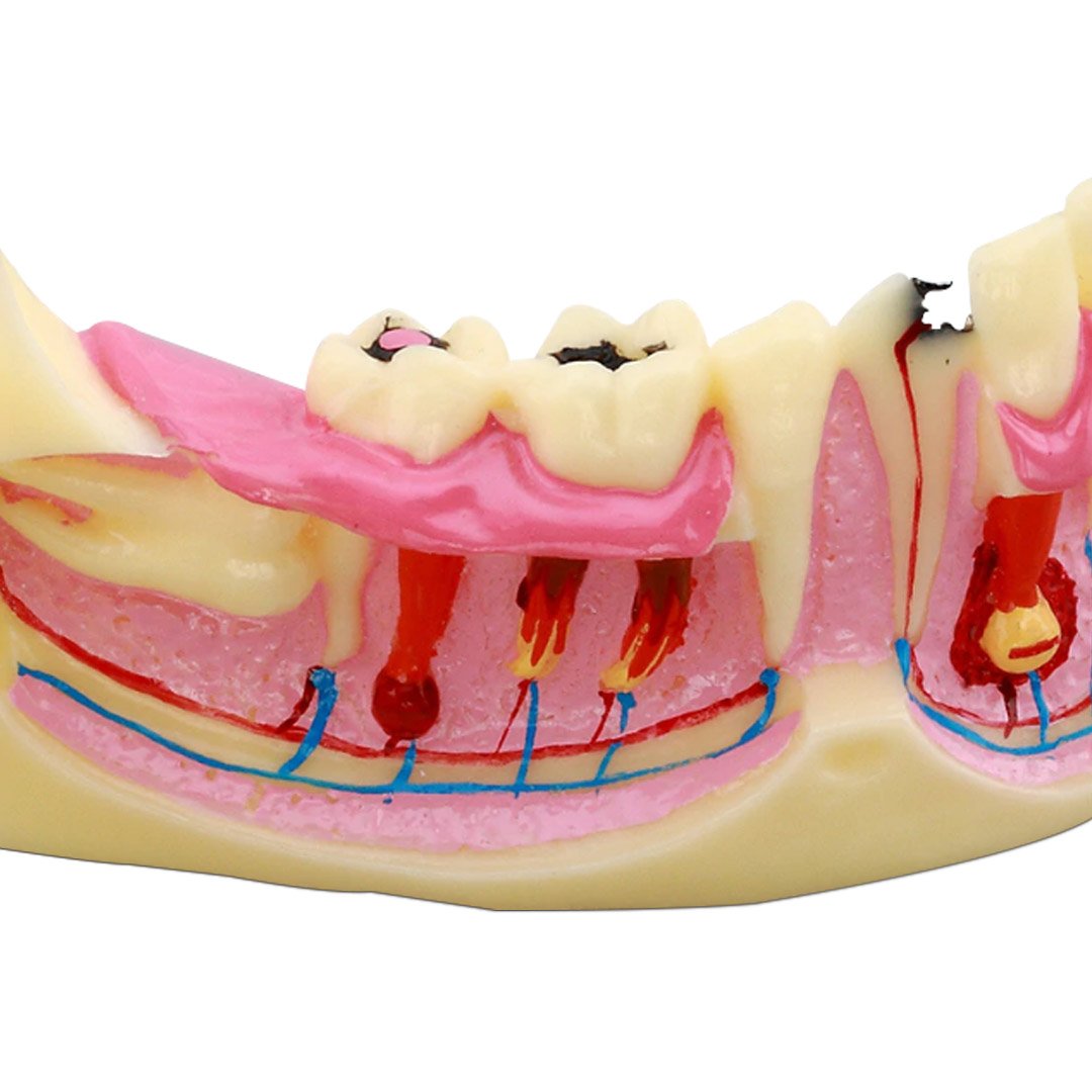 Mandible Bone Model