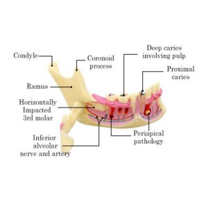 Mandible Bone Model