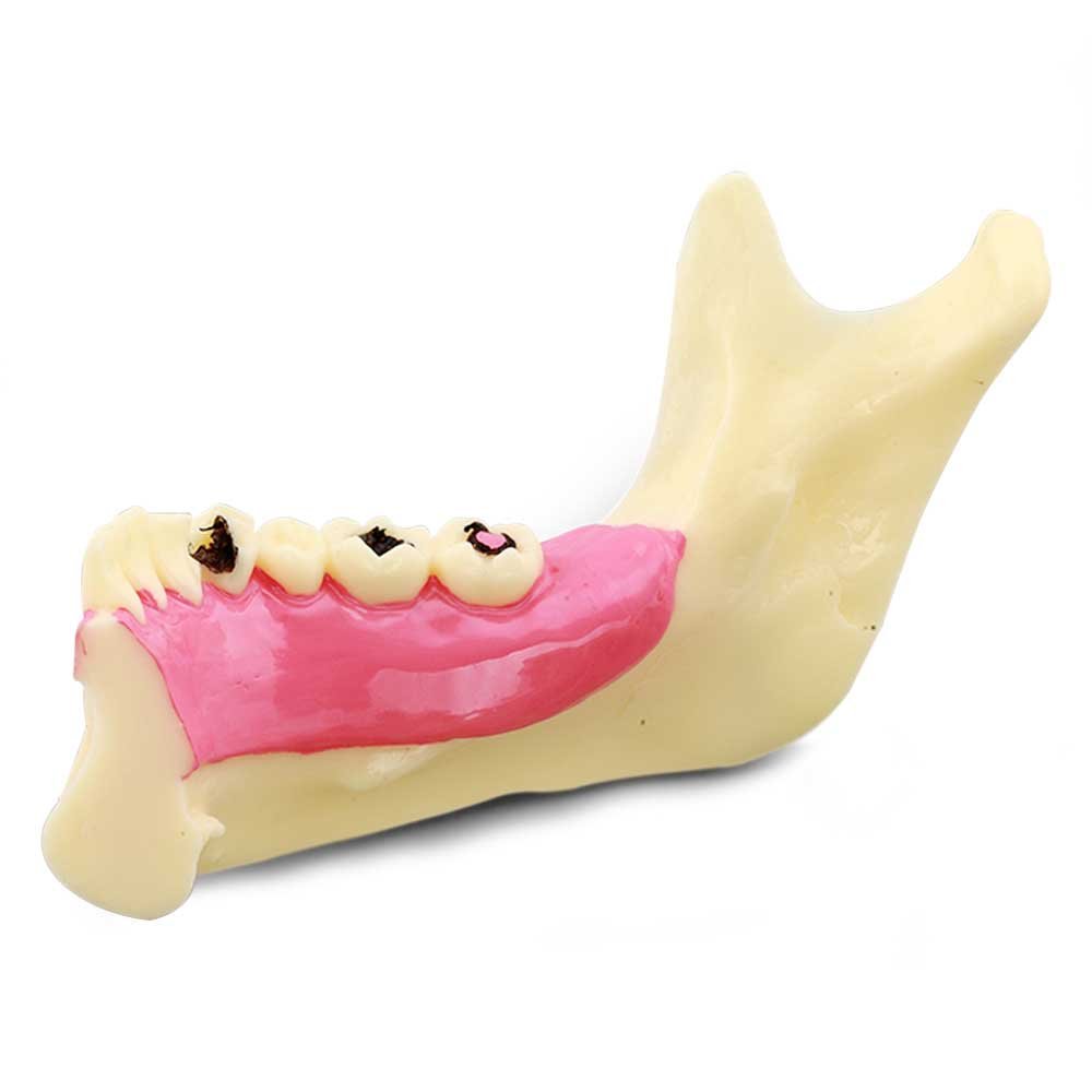 Mandible Bone Model