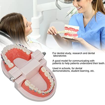 Patient Education Model With Orthodontic Brackets
