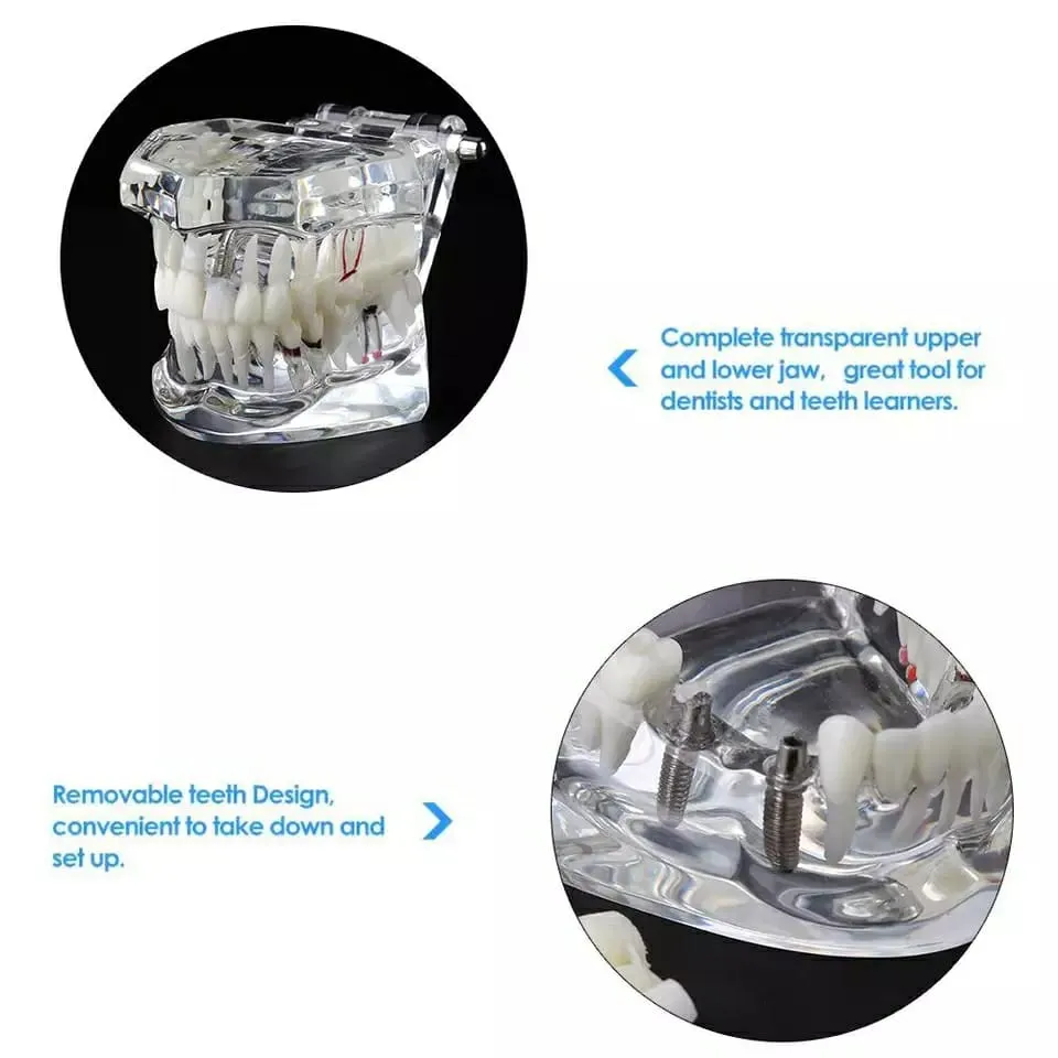 Dental All In One Model