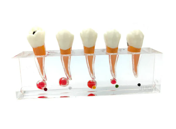 Endodontic Treatment Stages Model