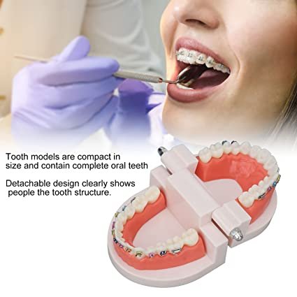 Patient Education Model With Orthodontic Brackets