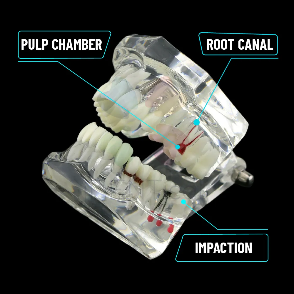 Dental All In One Model