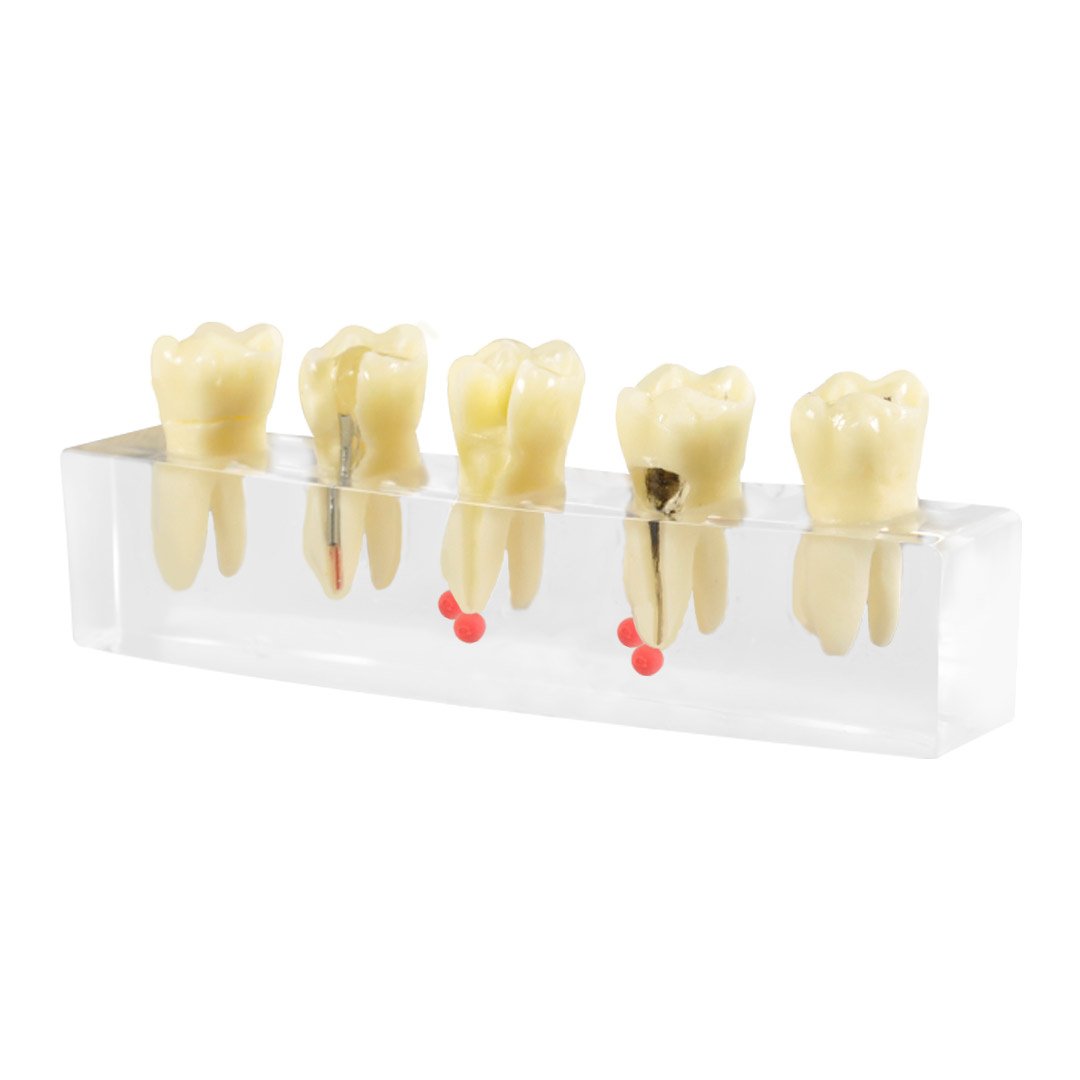 Root Canal Training Model | Endodontic Procedure Demonstration