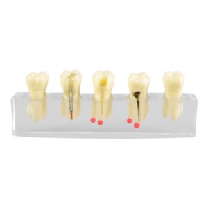 Root Canal Training Model | Endodontic Procedure Demonstration