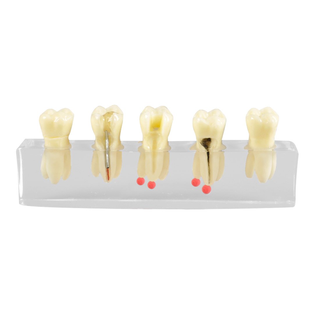 Root Canal Training Model | Endodontic Procedure Demonstration