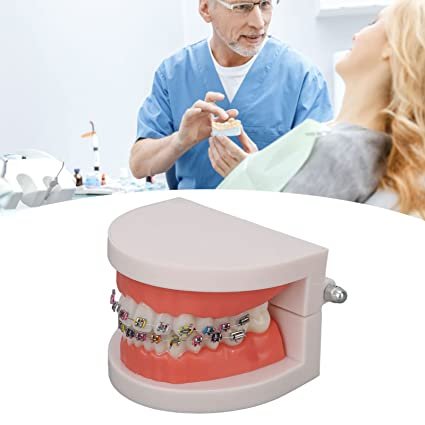 Patient Education Model With Orthodontic Brackets