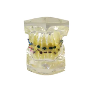 Orthodontic Model Clear | Transparent Jaw Study Model
