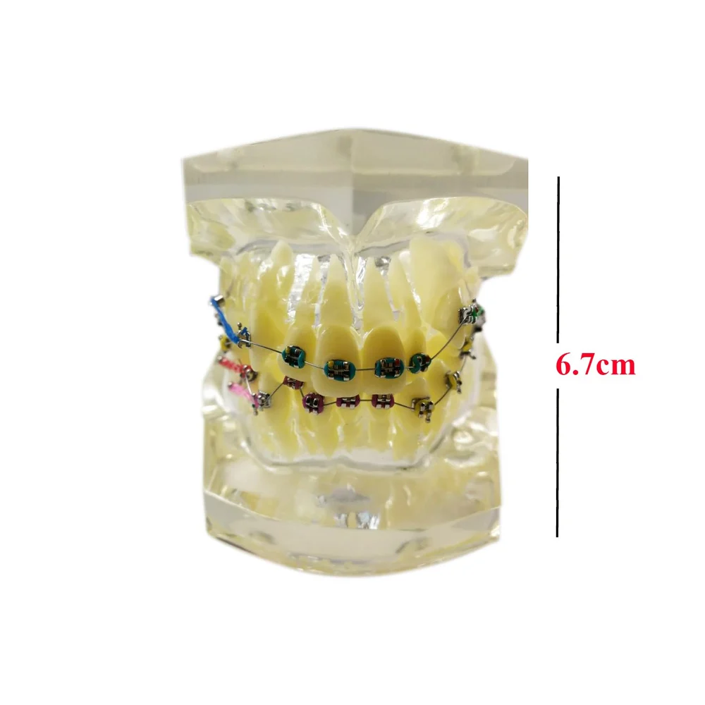 Orthodontic Model Clear | Transparent Jaw Study Model
