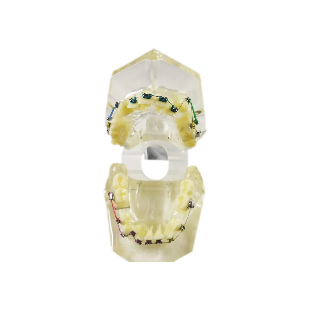 Orthodontic Model Clear | Transparent Jaw Study Model