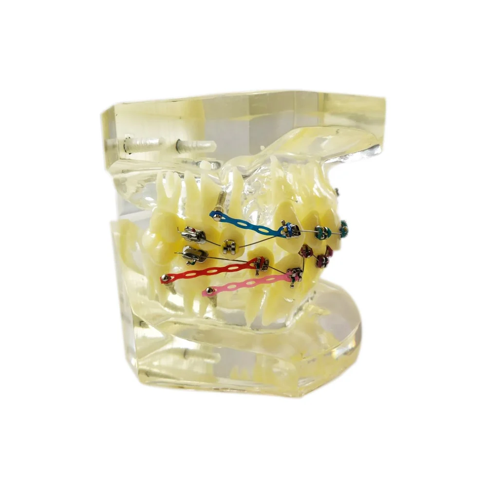 Orthodontic Model Clear | Transparent Jaw Study Model