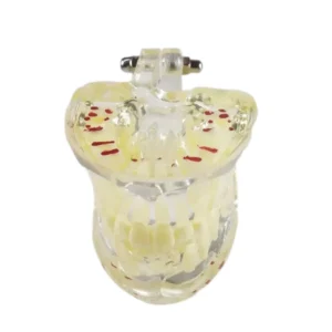 Pediatric Dental Model Age 7 – Mixed Dentition Educational Model