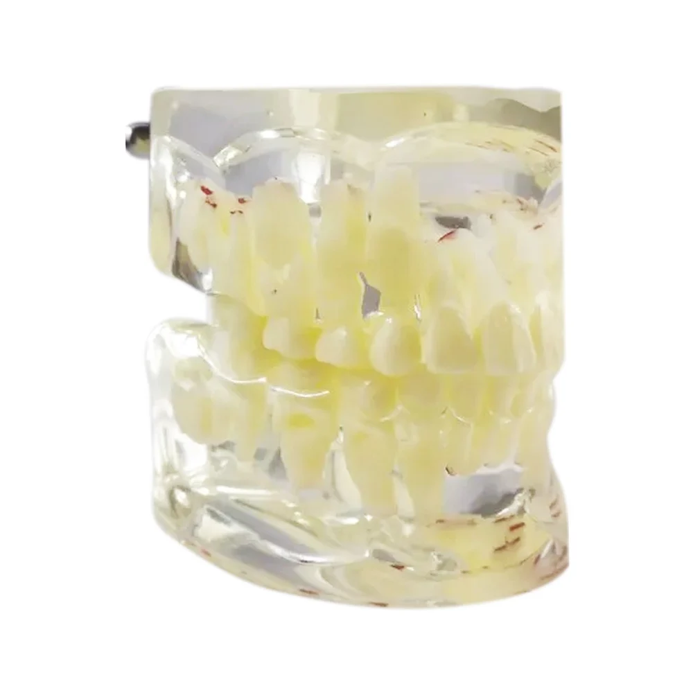 Pediatric Dental Model Age 7 – Mixed Dentition Educational Model