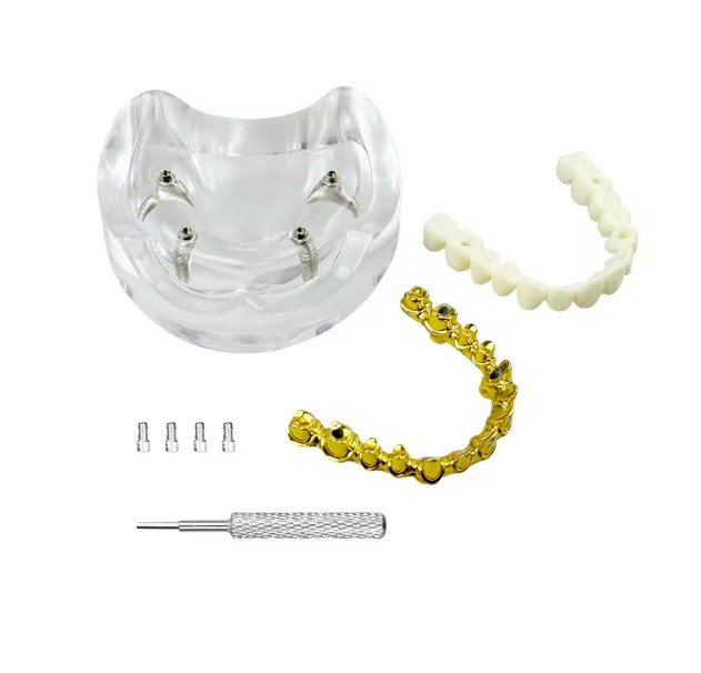 All-on-4 Paulo Malo Implant Model