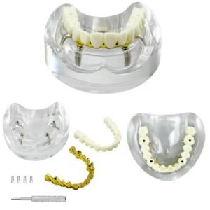 All-on-4 Paulo Malo Implant Model