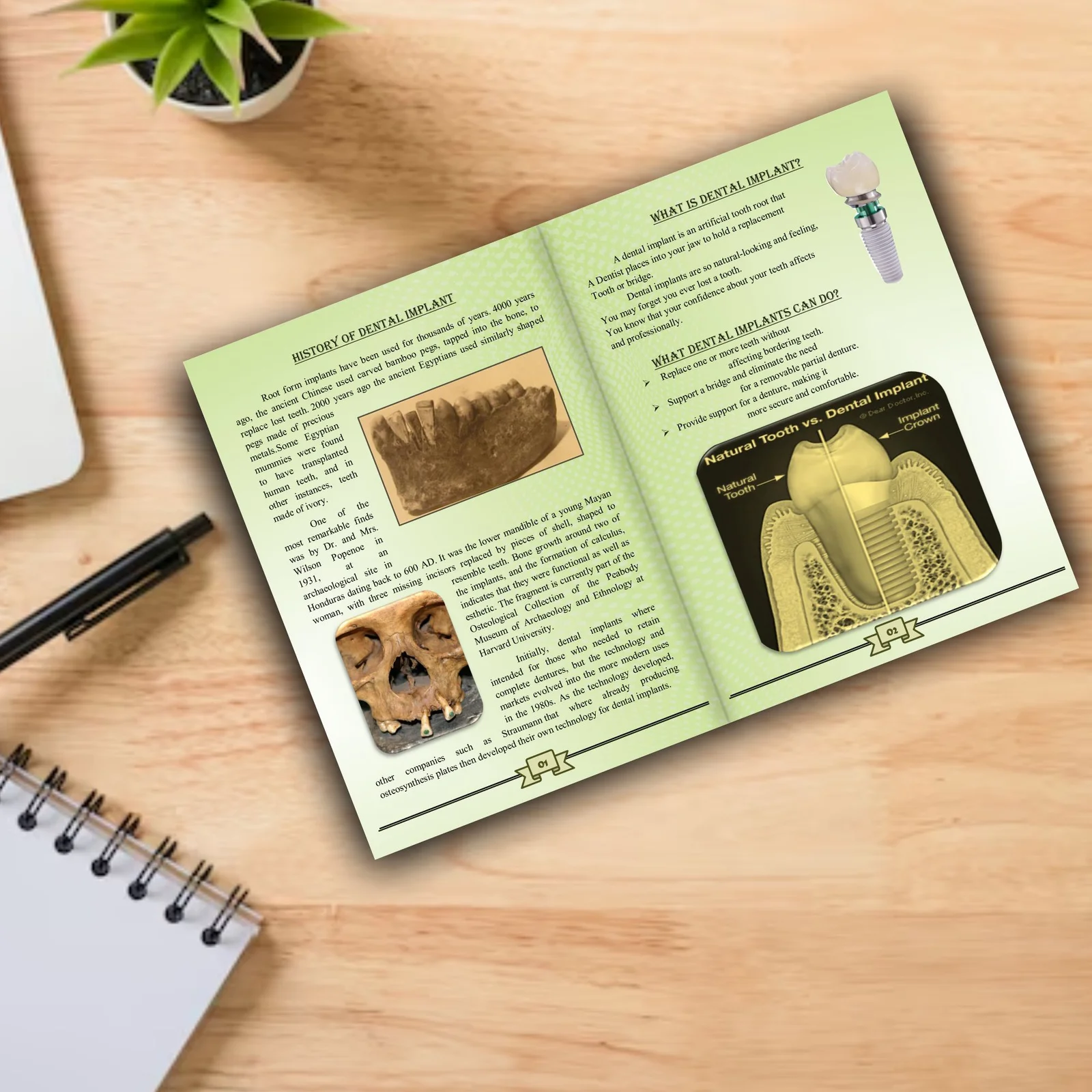 Implant Album Book (Pack of 5)