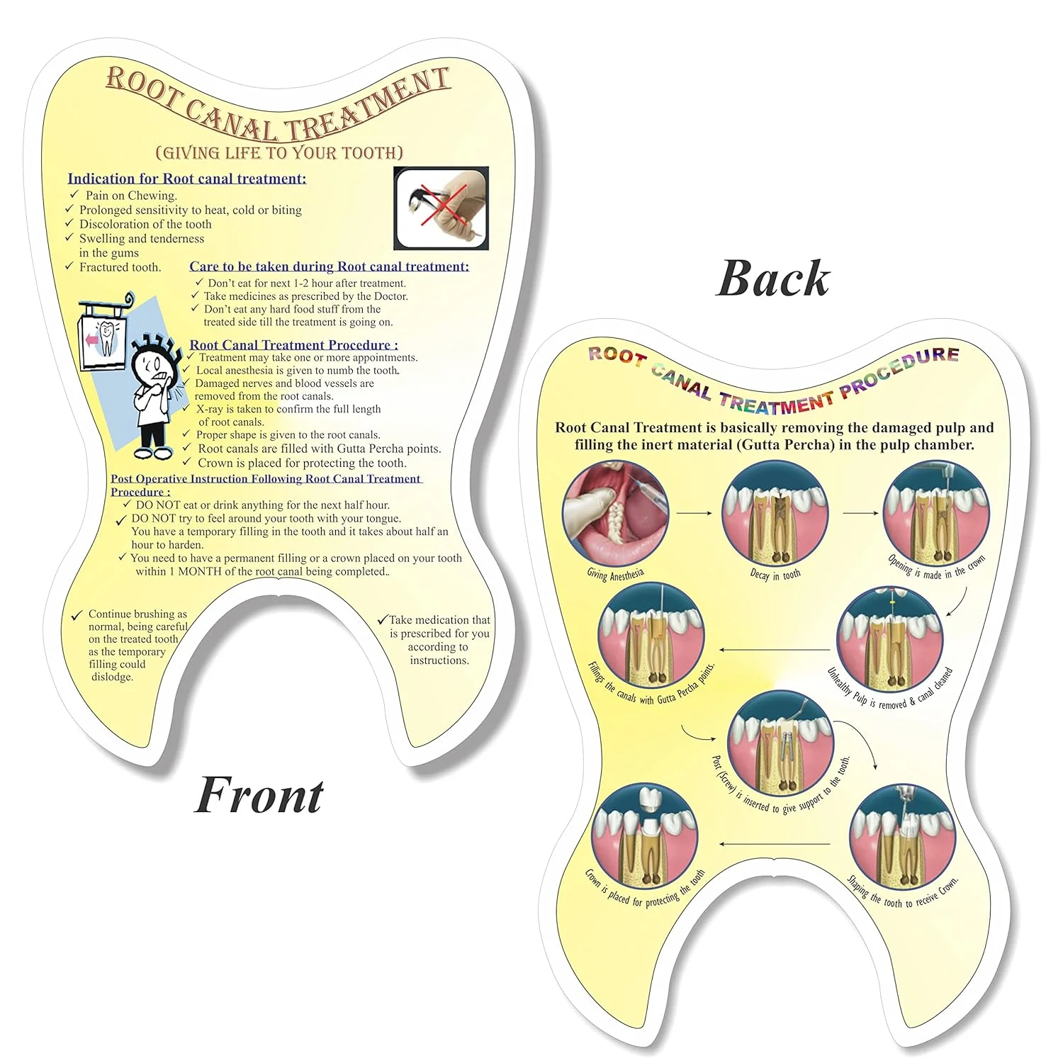 Root Canal Treatment