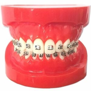 Metal Bracket Model – Red | Orthodontic Bracket Model