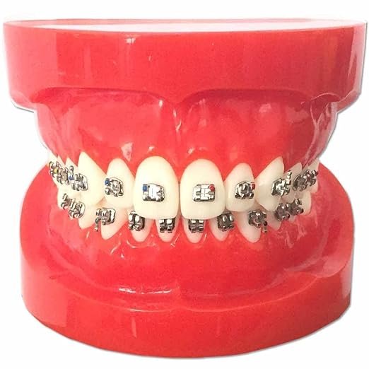 Metal Bracket Model - Red | Orthodontic Bracket Model