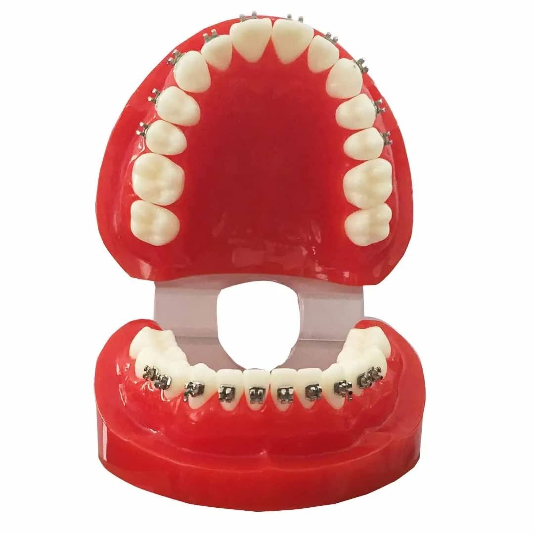 Metal Bracket Model - Red | Orthodontic Bracket Model