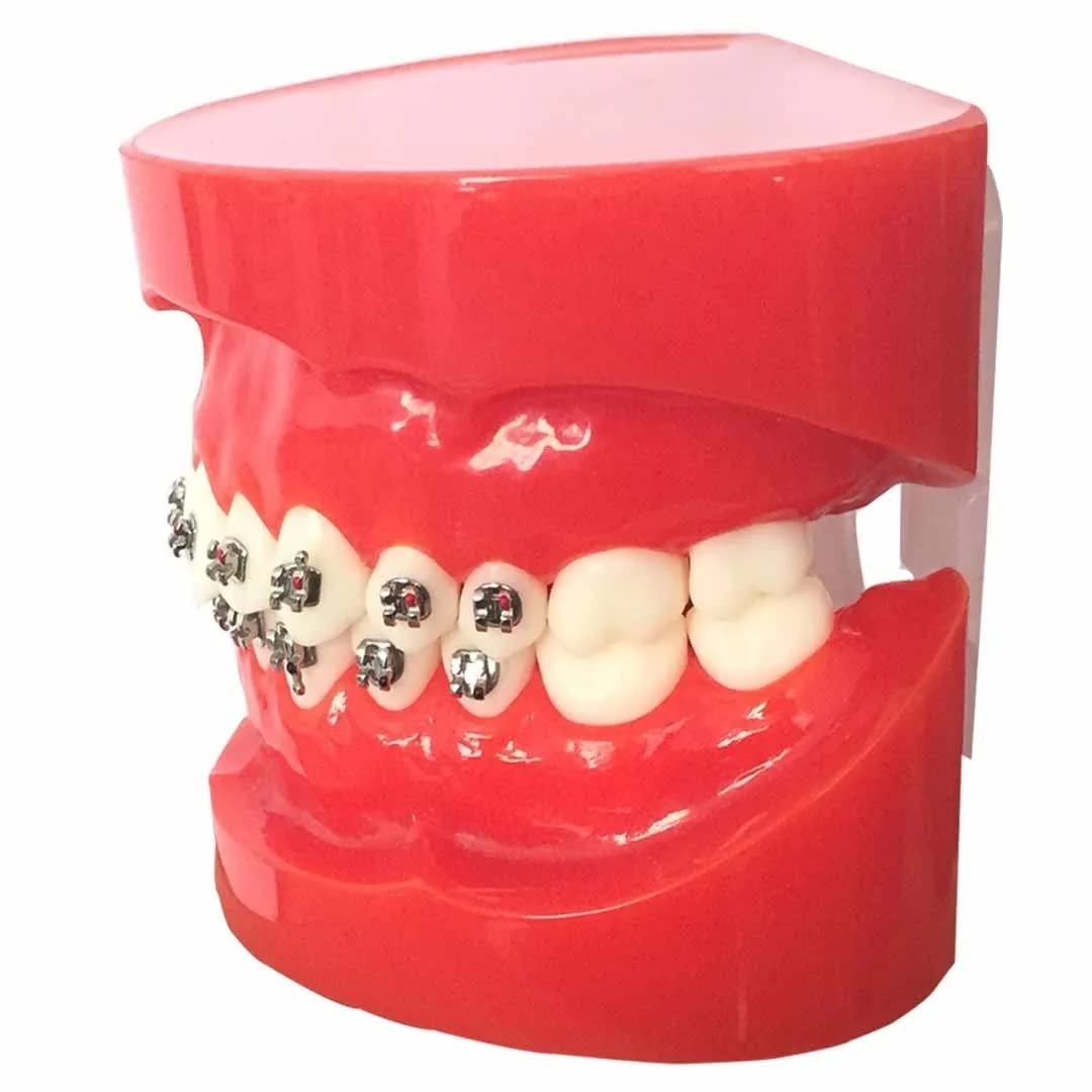 Metal Bracket Model - Red | Orthodontic Bracket Model