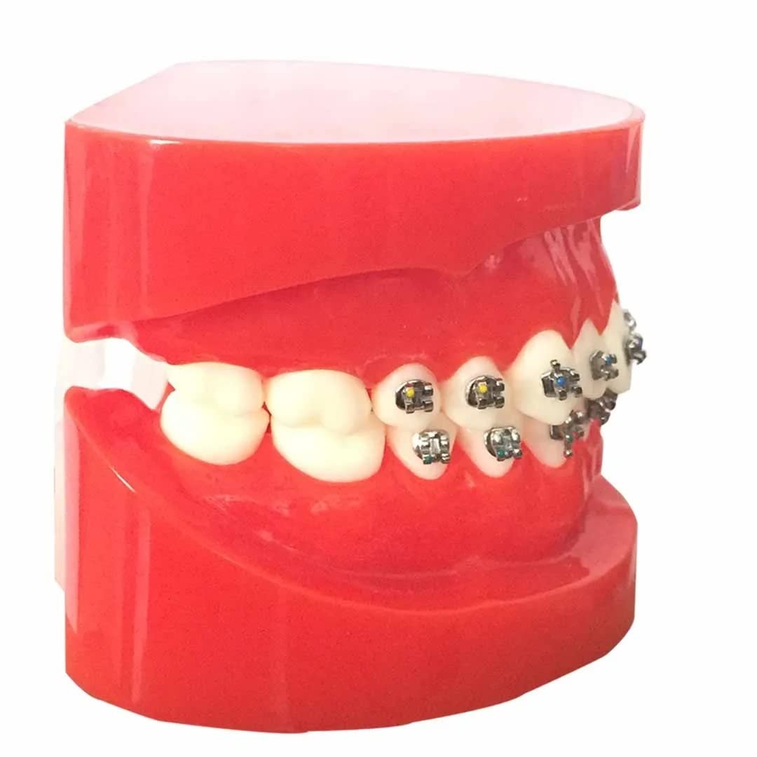 Metal Bracket Model - Red | Orthodontic Bracket Model