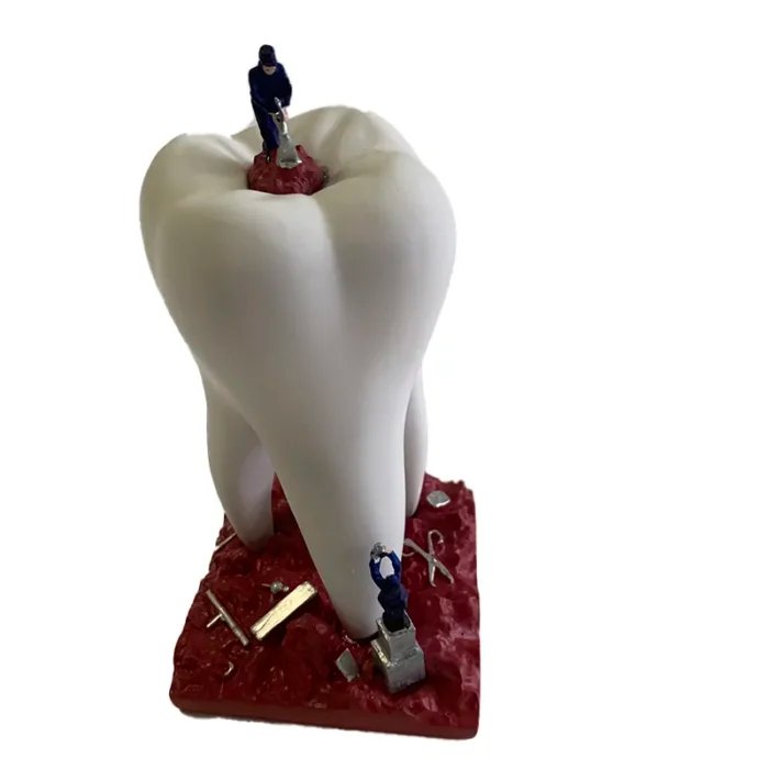 Sculpture of Big Teeth and Little Soldiers – Dental Figurine for Clinic Decoration & Patient Engagement