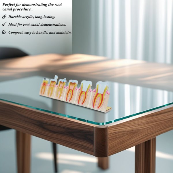 2D Root Canal Treatment Process Model – Step-by-Step Anatomy