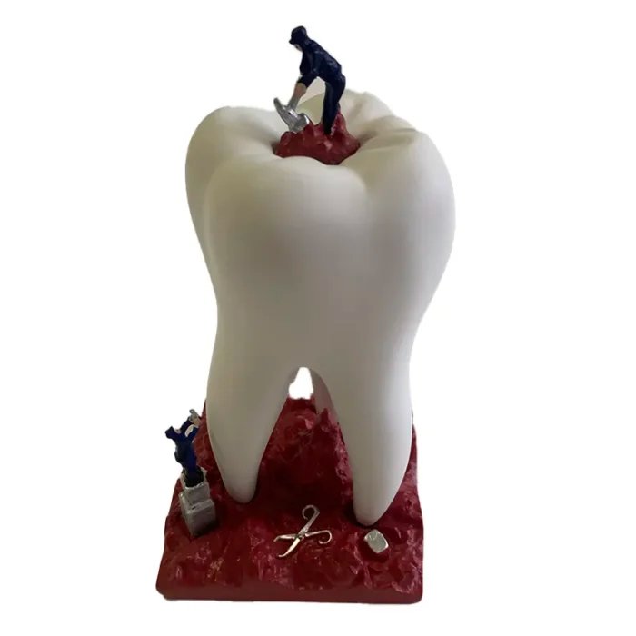 Sculpture of Big Teeth and Little Soldiers – Dental Figurine for Clinic Decoration & Patient Engagement
