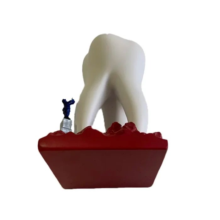 Sculpture of Big Teeth and Little Soldiers – Dental Figurine for Clinic Decoration & Patient Engagement