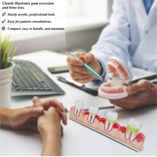 2D Periodontal Disease Progression Model – Healthy to Advanced Stages