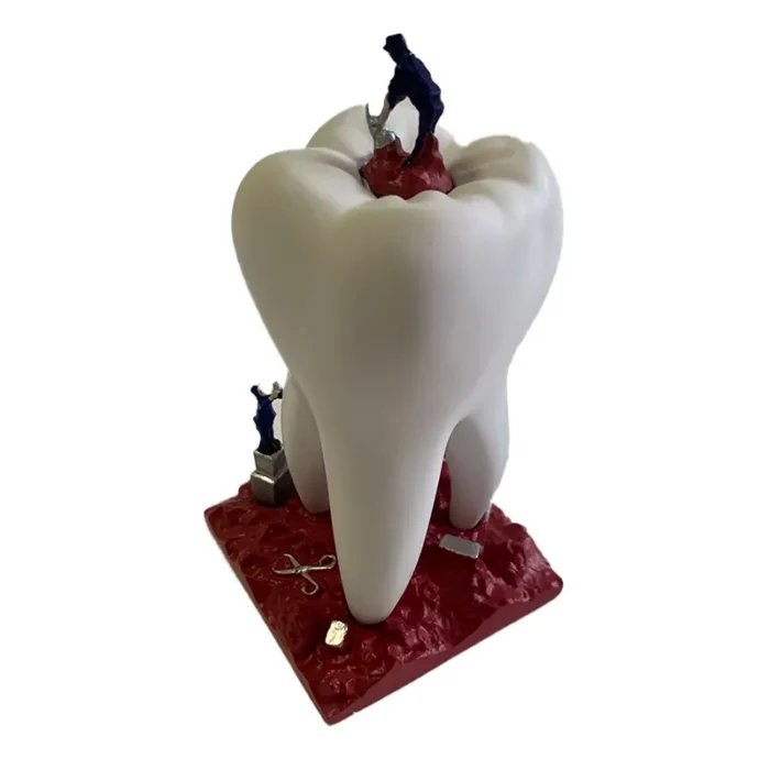 Sculpture of Big Teeth and Little Soldiers – Dental Figurine for Clinic Decoration & Patient Engagement