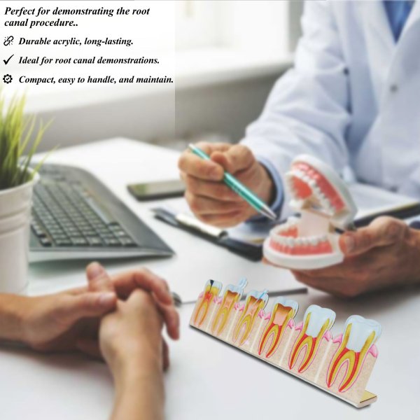 2D Root Canal Treatment Process Model – Step-by-Step Anatomy